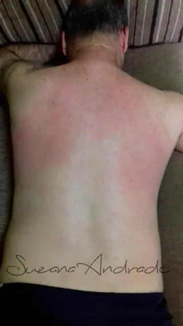 Costas depois da depilação masculina